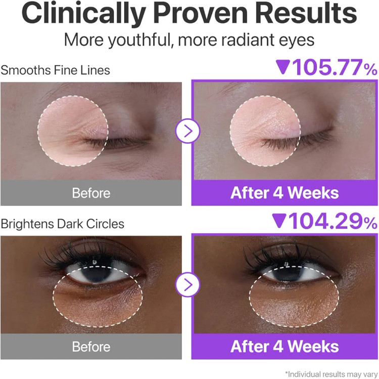 کرم دور چشم ضدچروک و جوانساز نامبوزین شماره ۹ حاوی رتینول، NAD+ و ۵۰ پپتید