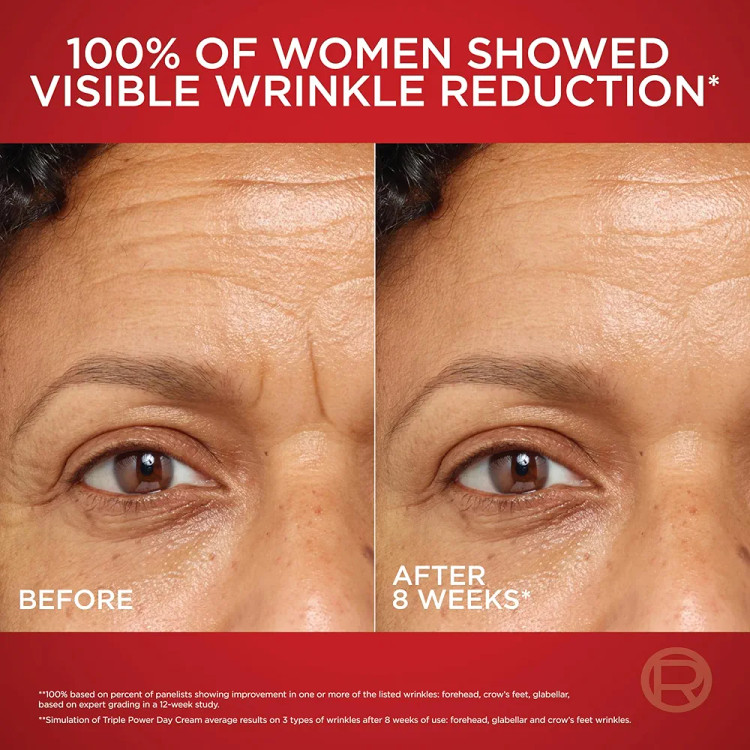 کرم ضدچروک روز لورآل پاریس Revitalift Laser Triple Action فرمول جدید با پرو رتینول و پپتاید آرژیرلین 50 میل