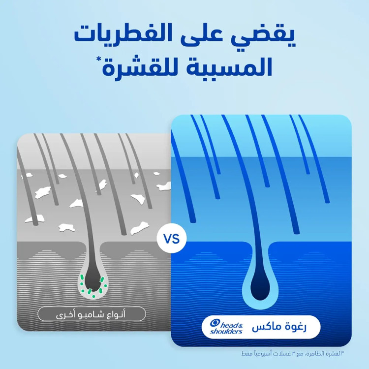 شامپو ضد شوره هد اند شولدرز مدل Dry Scalp Care با روغن بادام | مناسب پوست سر خشک | 400 میلیلیتر